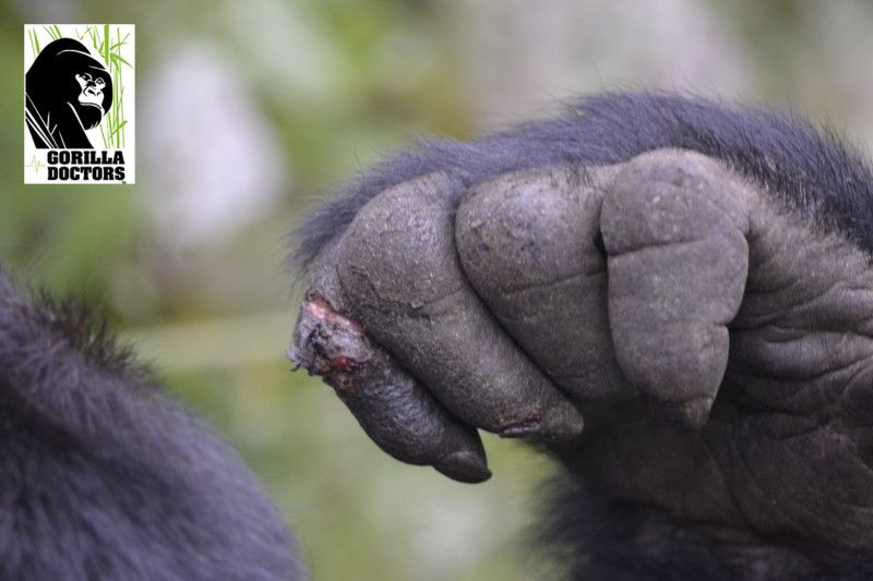 Kabandize’s wound on his right finger. Photo Credit/Gorillas Doctors